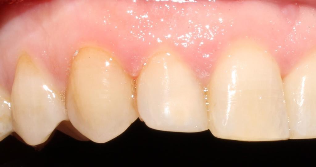 After image
