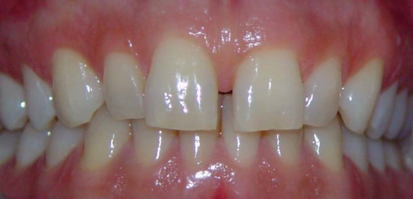 Before image