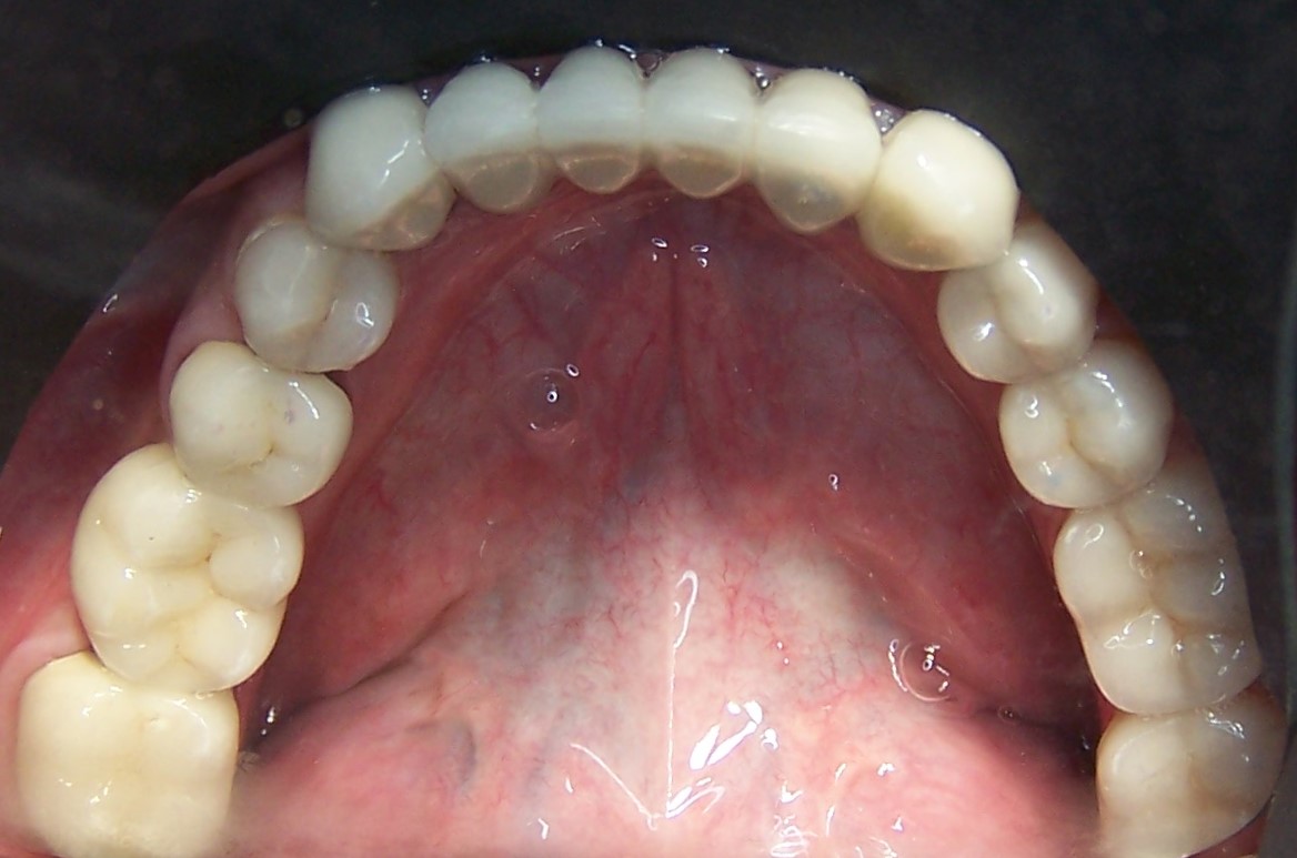 After image